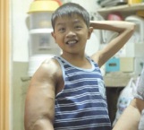 A los 4 años, su brazo comenzó a crecer sin control