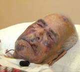 Un mexicano de 92 años fue golpeado con un ladrillo en la cara