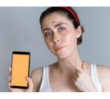 Cómo evitar que el uso del celular provoque acné